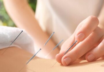 8 Best Fertility Acupuncturists in Canberra